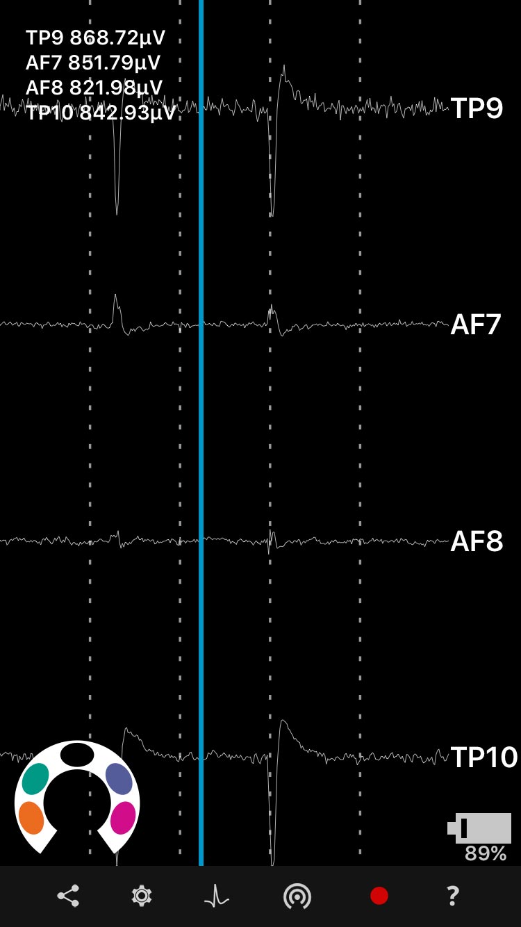 Raw microvolts